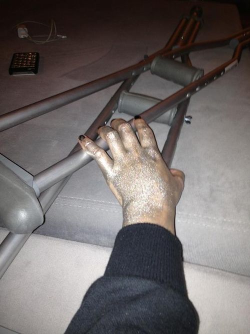 Demi Lovato złamała nogę (FOTO) Demi Lovato złamała nogę (FOTO)