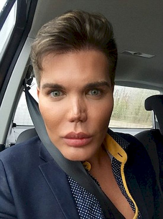 Żywemu Kenowi ODPADA NOS! Rodrigo Alves przesadził z operacjami