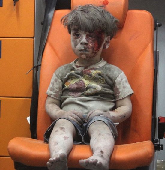 Dalsze losy rannego chłopca z Aleppo przywracają wiarę w ludzkość