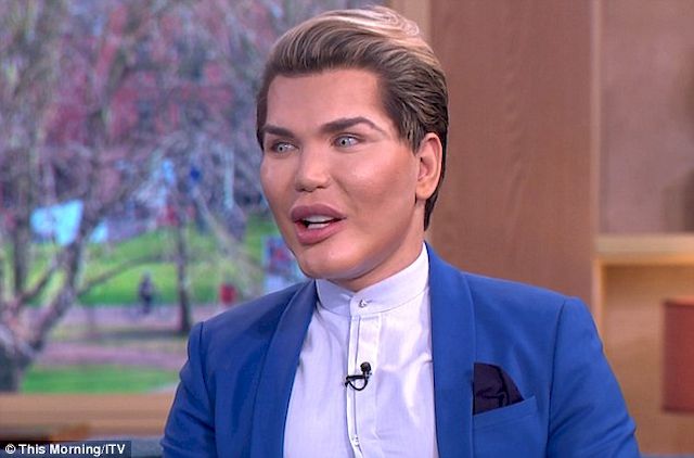 Żywemu Kenowi ODPADA NOS! Rodrigo Alves przesadził z operacjami
