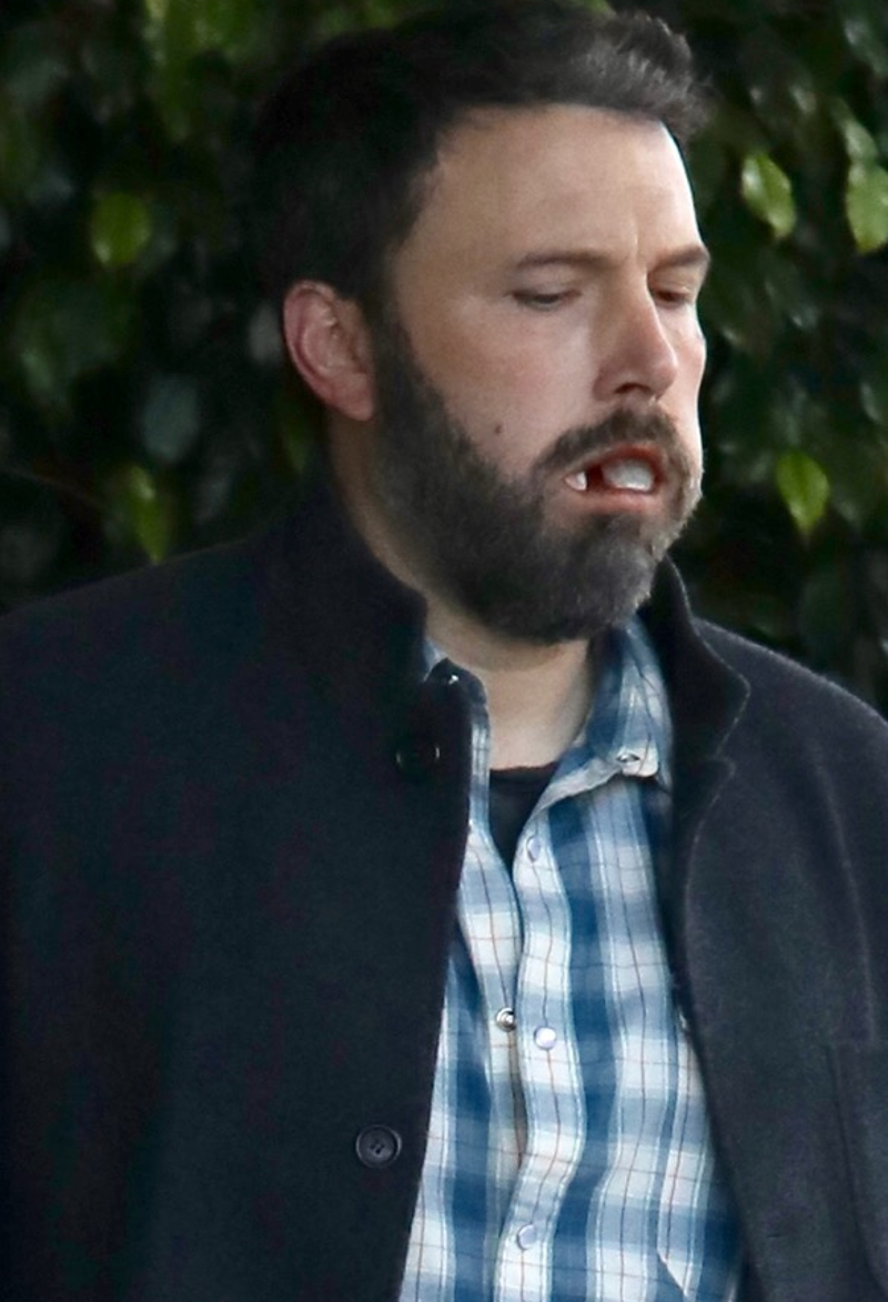 Opuchnięty Ben Affleck wychodzi od dentysty. To musiało boleć. Opuchnięty Ben Affleck wychodzi od dentysty. To musiało boleć.