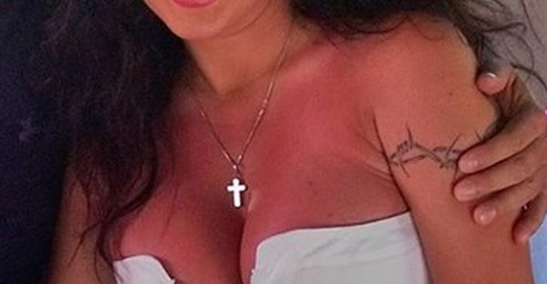 Iwona Węgrowska poparzyła sobie piersi (FOTO)