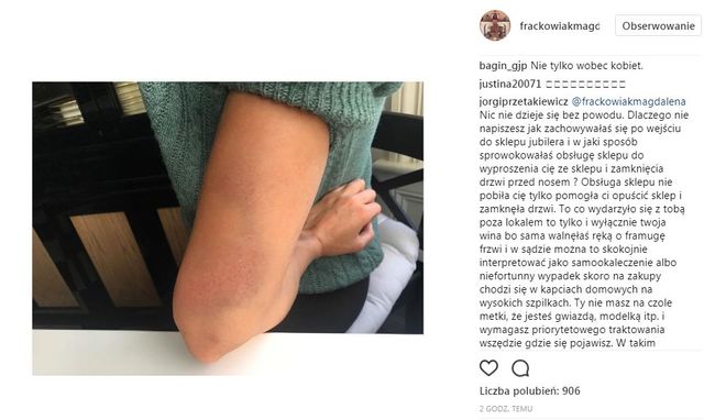 Magdalena Frąckowiak: Anonimowi psychole grasują w internecie Magdalena Frąckowiak: Anonimowi psychole grasują w internecie