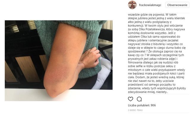 Magdalena Frąckowiak: Anonimowi psychole grasują w internecie Magdalena Frąckowiak: Anonimowi psychole grasują w internecie