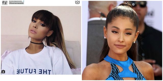 Gwiazdy Z GRZYWKAMI i bez - kiedy było lepiej? (ZDJĘCIA)