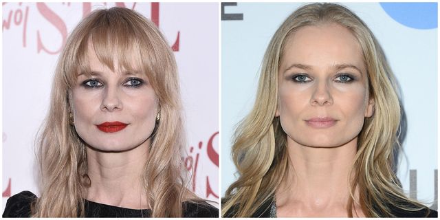 Gwiazdy Z GRZYWKAMI i bez - kiedy było lepiej? (ZDJĘCIA)