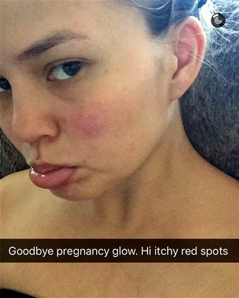 Chrissy Teigen zbrzydła po urodzeniu dziecka? (Snapchat)