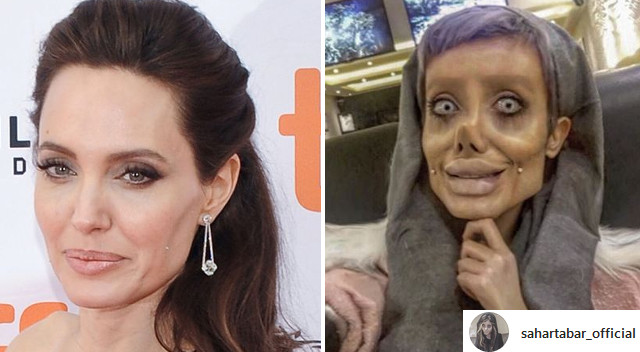 Jej marzeniem było być jak Angelina Jolie, a teraz STRASZY swoim wyglądem Jej marzeniem było być jak Angelina Jolie, a teraz STRASZY swoim wyglądem