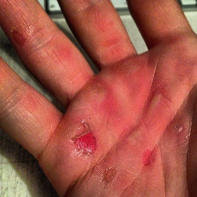 Od ostrych treningów crossfit ma rany na rękach (FOTO)