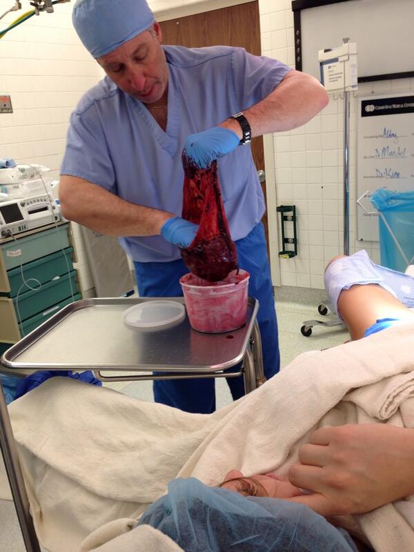 Szok! Żona aktora American Pie pokazała swoje łożysko (FOTO) Szok! Żona aktora American Pie pokazała swoje łożysko (FOTO)