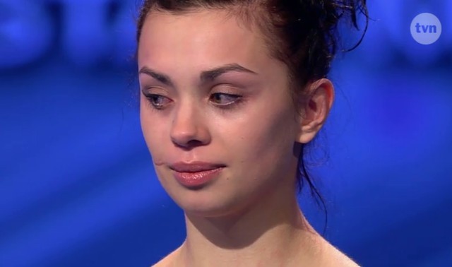 Anna Koryto - dziewczyna z blizną na twarz w Top Model (FOTO