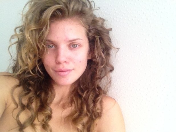 AnnaLynne McCord ma trądzik i się go nie wstydzi (FOTO)