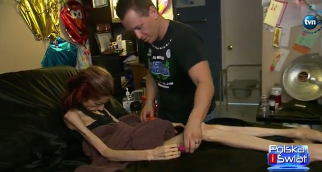 Rachael Farrokh ma 37 lat i waży 20 kilogramów