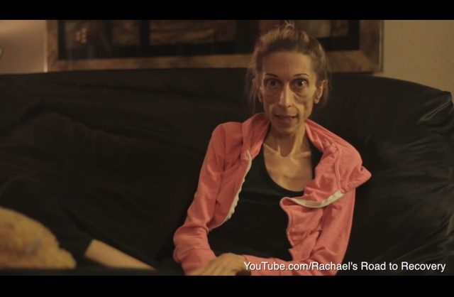 Szok. Ta aktorka chora na anoreksję ważyła niecałe 20 kg