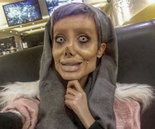 Jej marzeniem było być jak Angelina Jolie, a teraz STRASZY swoim wyglądem Jej marzeniem było być jak Angelina Jolie, a teraz STRASZY swoim wyglądem