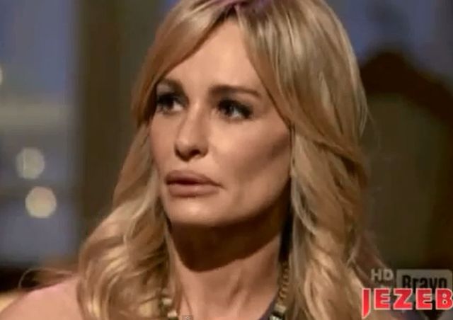 Gdy botoks nie pozwala płakać... (FOTO) Gdy botoks nie pozwala płakać... (FOTO)