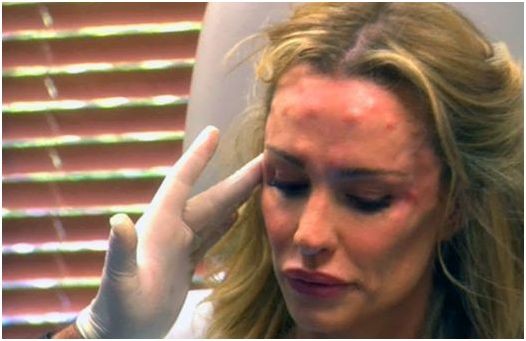 Gdy botoks nie pozwala płakać... (FOTO) Gdy botoks nie pozwala płakać... (FOTO)