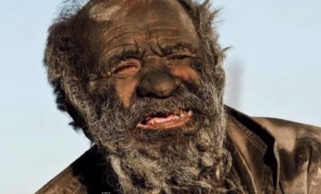 Ten mężczyzna nie myje się o 60 lat! Ten mężczyzna nie myje się o 60 lat!