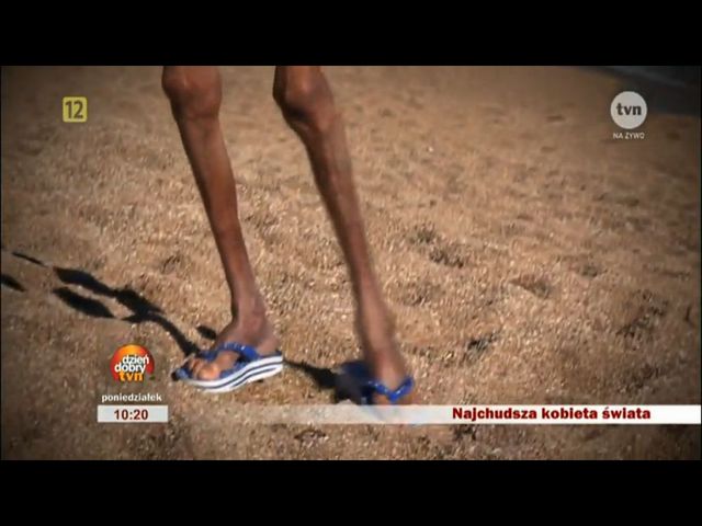 Najchudsza kobieta świata u Ewy Drzyzgi