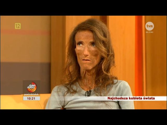 Najchudsza kobieta świata u Ewy Drzyzgi