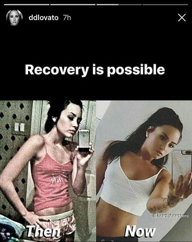 Znana wokalistka pokazała zdjęcie sprzed leczenia bulimii. Wyglądała STRASZNIE