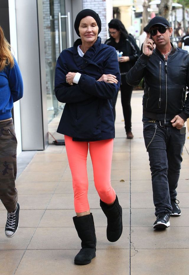 OMG - kiedyś była piękną modelką! Co się dzieje z twarzą Janice Dickinson? (FOTO OMG - kiedyś była piękną modelką! Co się dzieje z twarzą Janice Dickinson? (FOTO