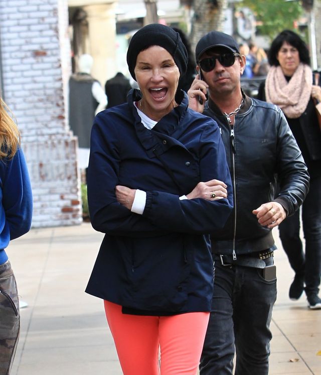 OMG - kiedyś była piękną modelką! Co się dzieje z twarzą Janice Dickinson? (FOTO OMG - kiedyś była piękną modelką! Co się dzieje z twarzą Janice Dickinson? (FOTO