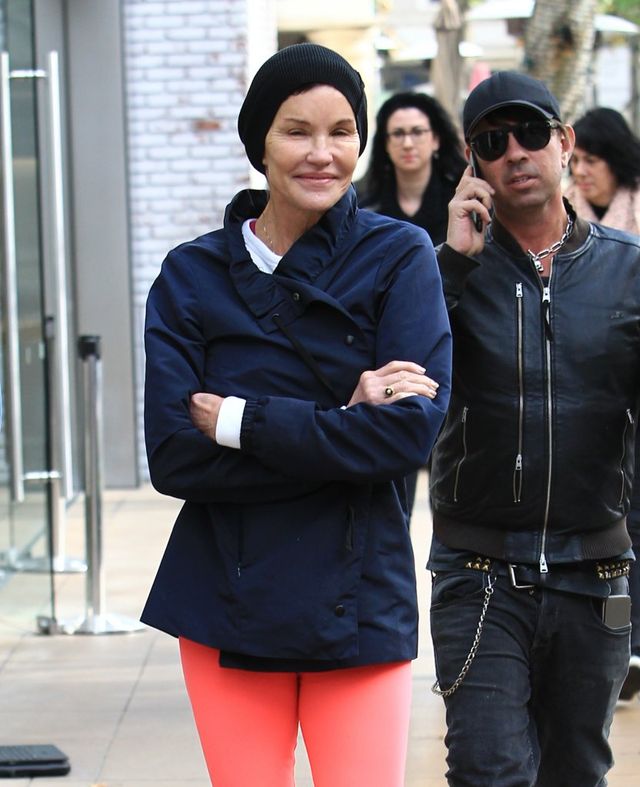 OMG - kiedyś była piękną modelką! Co się dzieje z twarzą Janice Dickinson? (FOTO OMG - kiedyś była piękną modelką! Co się dzieje z twarzą Janice Dickinson? (FOTO