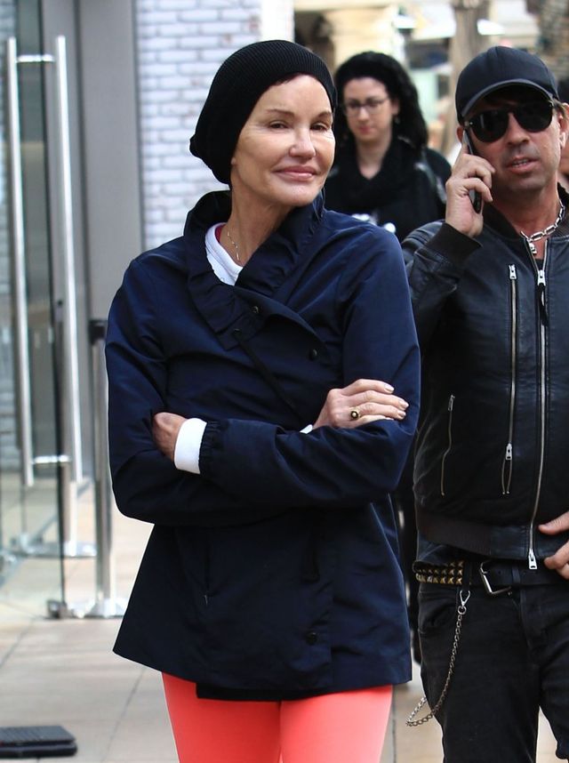 OMG - kiedyś była piękną modelką! Co się dzieje z twarzą Janice Dickinson? (FOTO OMG - kiedyś była piękną modelką! Co się dzieje z twarzą Janice Dickinson? (FOTO