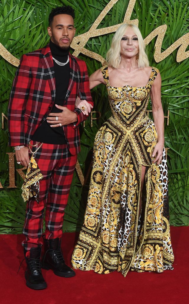 Obwisła skróa na ramionach wielkiej fanki operacji plastycznych (ZDJĘCIA) Obwisła skróa na ramionach wielkiej fanki operacji plastycznych (ZDJĘCIA)