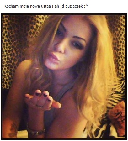 Ania z Ekipy z Warszawy powiększyła sobie usta! (FOTO) Ania z Ekipy z Warszawy powiększyła sobie usta! (FOTO)