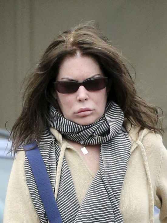 Lara Flynn Boyle zmasakrowała sobie twarz! (FOTO)