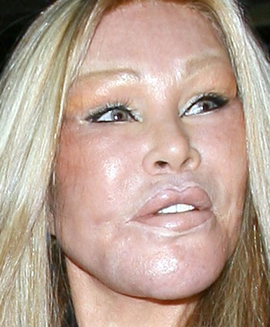 Zoperowane do granic możliwości idą na kolację (FOTO)