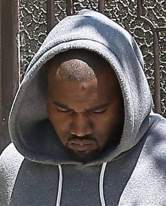 Kanye West z raną na czole (FOTO)