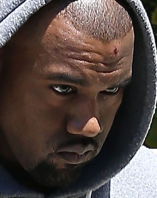 Kanye West z raną na czole (FOTO)