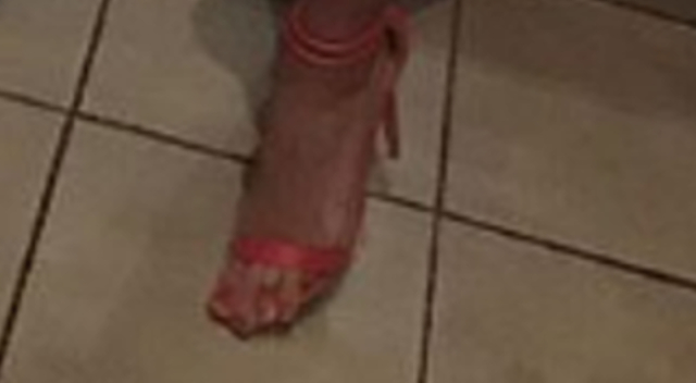 Fuu! Co się stało z PALCAMI Godlewskiej?