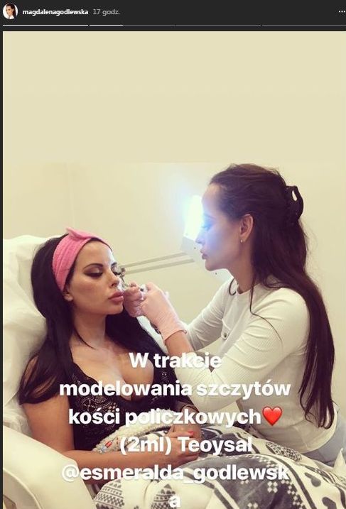 Esmeralda Godlewska pokazuje, jak sobie ROBI policzki Esmeralda Godlewska pokazuje, jak sobie ROBI policzki