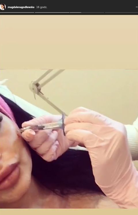 Esmeralda Godlewska pokazuje, jak sobie ROBI policzki Esmeralda Godlewska pokazuje, jak sobie ROBI policzki