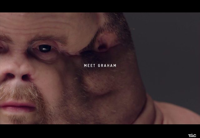 Poznajcie Grahama - niezwykłego człowieka, który przetrwał wypadek