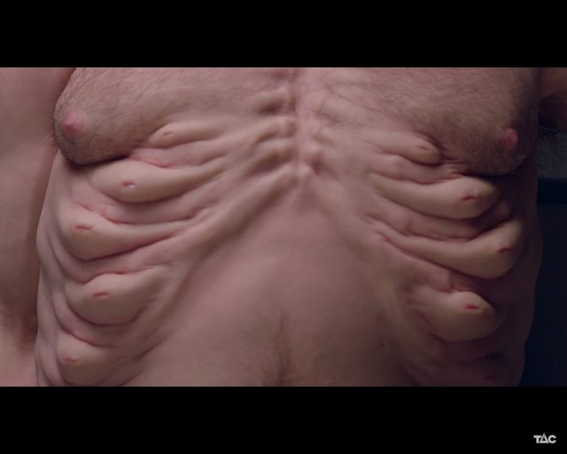 Poznajcie Grahama - niezwykłego człowieka, który przetrwał wypadek