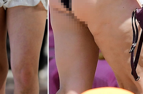 Hayden Panettiere pokazała się z wielkim partnerem i sporym CELLULITEM