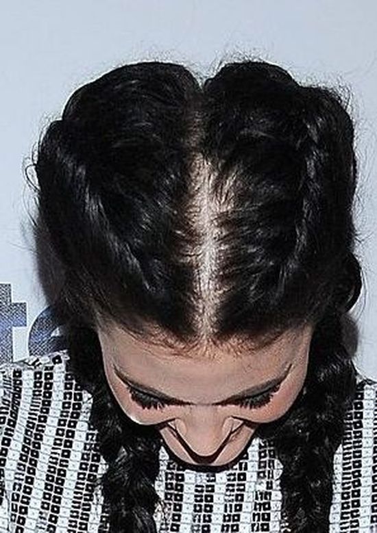 Honorata Skarbek powinna uważać na doczepy? (FOTO)