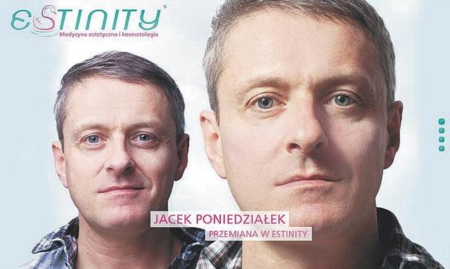 Jacek Poniedziałek dał sobie wstrzyknąć kwas hialuronowy Jacek Poniedziałek dał sobie wstrzyknąć kwas hialuronowy