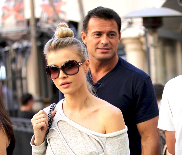 Polska modelka z siniakiem na szyi (FOTO)