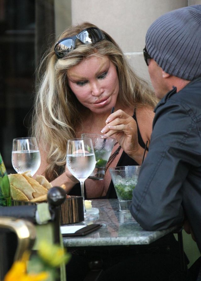 Jak wyglądała kobieta - kot przed operacjami? I dlaczego chciała wyglądać jak KO