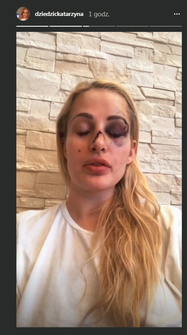 Wciekły nagrania trenera-sadysty: POŁAMIĘ jej żuchwę, aż będzie miękka!