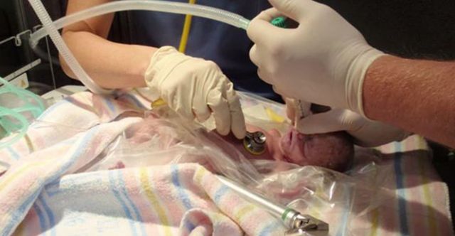 Nie przeżył porodu, ale zdarzył się cud (VIDEO)