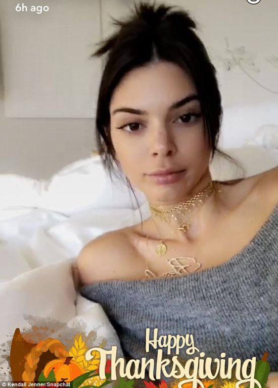 Te zdjęcia pokazują, że Kendall Jenner powiekszyła usta i wygląda jak nie ona