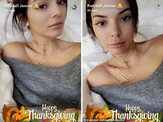 Te zdjęcia pokazują, że Kendall Jenner powiekszyła usta i wygląda jak nie ona