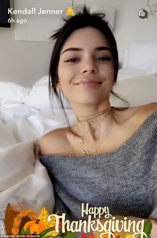 Te zdjęcia pokazują, że Kendall Jenner powiekszyła usta i wygląda jak nie ona